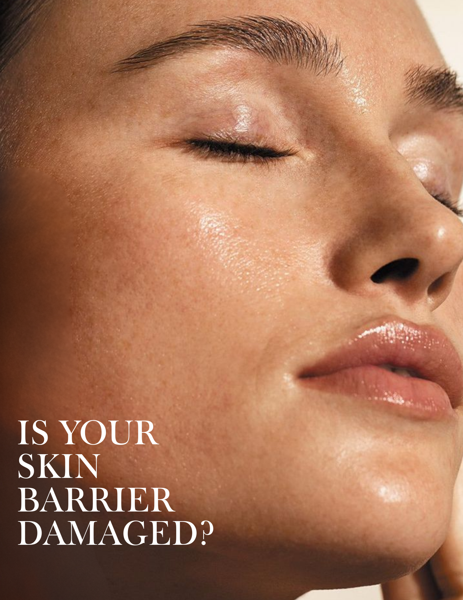 Skin Barrier repair 101:  How to heal damaged skin naturally